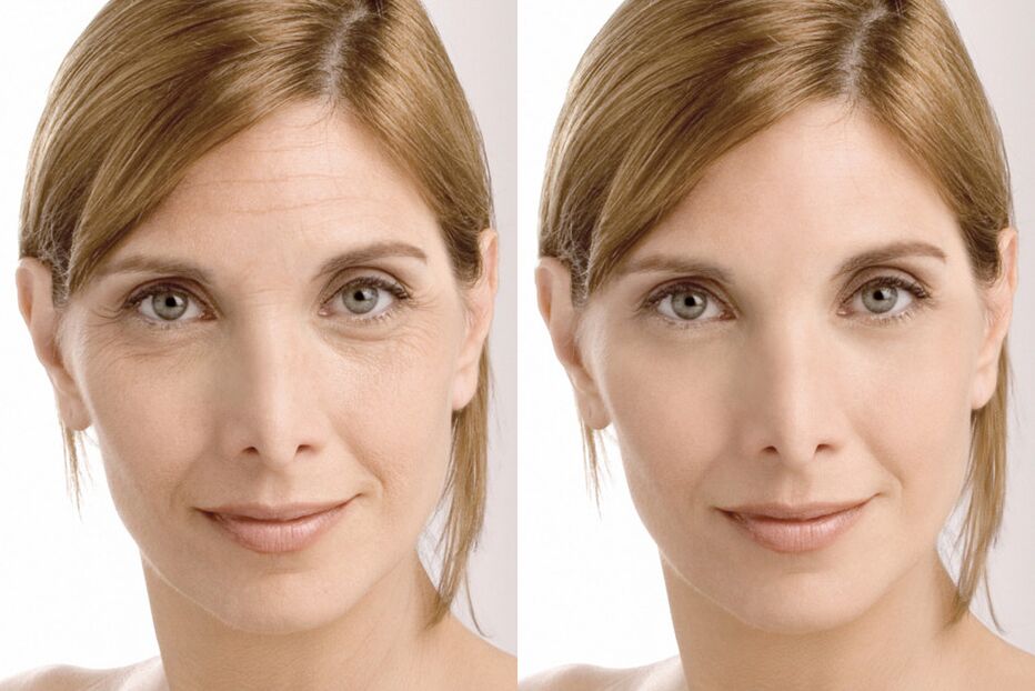 Milana intenskin facial cream before and after experience